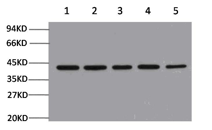 Anti-Beta-Actin Antibody (4T285)