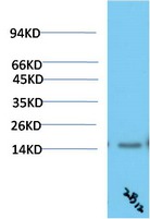 Anti-Transthyretin Antibody (8S642)