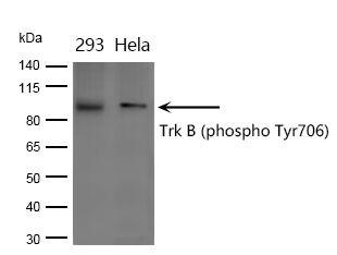 Anti-Phospho-NTRK2 (Tyr706) Polyclonal Antibody 2