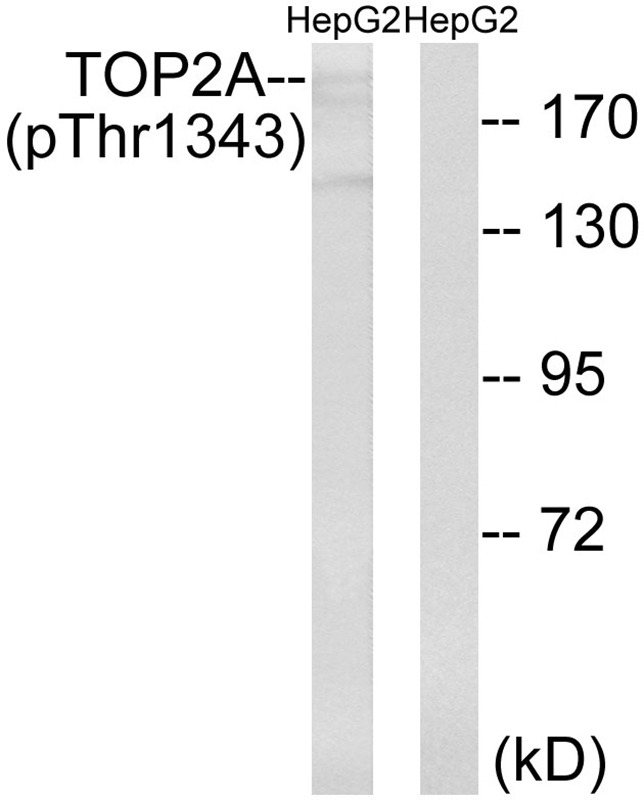 Anti-Phospho-TOP2A (Thr1343) Polyclonal Antibody 2