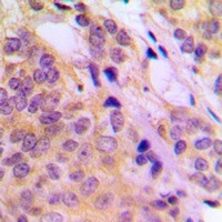 Anti-Phospho-MAP3K8 (Thr290) Polyclonal Antibody