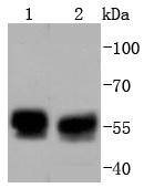 Anti-TRK fused gene Antibody (4L658)