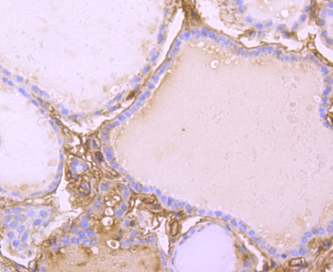 Anti-Transthyretin Antibody (5H602)