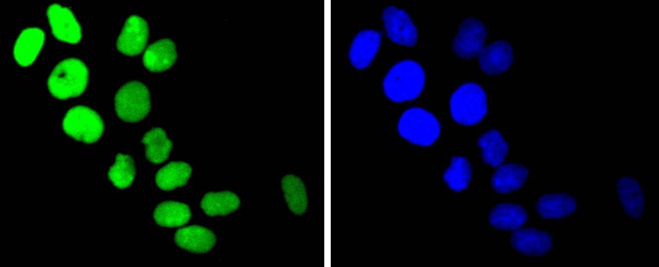 Anti-TOP1 Antibody (4H437)