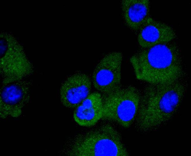 Anti-TRK fused gene Antibody (4L658)