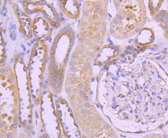 Anti-TRK fused gene Antibody (4L658)