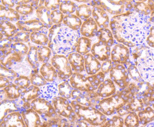 Anti-TOP2A Antibody (4D479)