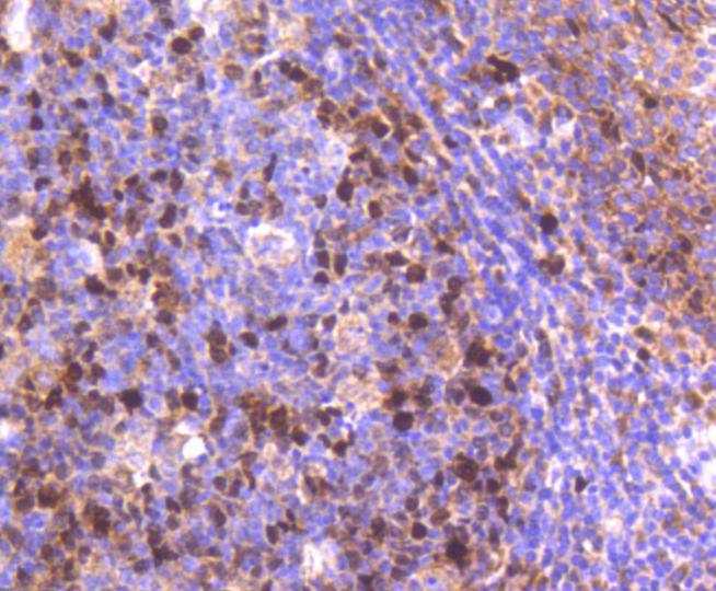 Anti-TOP2A Antibody (4D479)