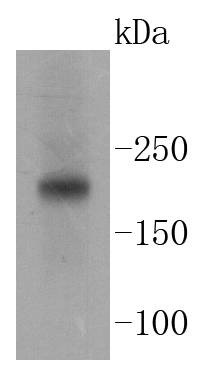 Anti-Tuberin Antibody (9I375)