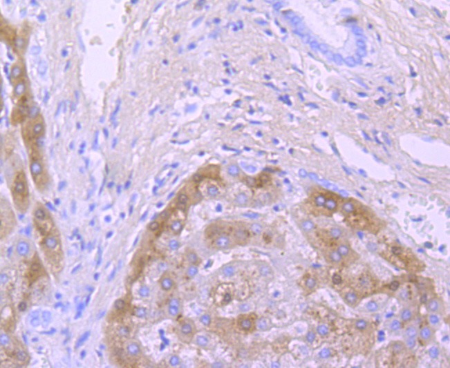 Anti-Transthyretin Antibody (5H602)