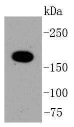 Anti-TOP2A Antibody (4D479)