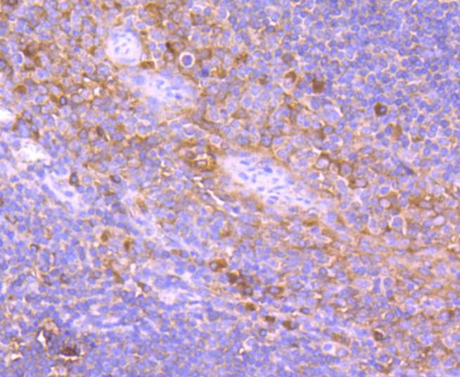 Anti-TRK fused gene Antibody (4L658)