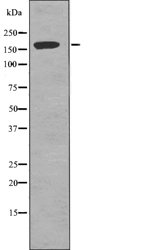 Anti-Phospho-TOP2A (Ser1337) Polyclonal Antibody
