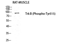 Anti-Phospho-NTRK2 (Tyr516) Polyclonal Antibody