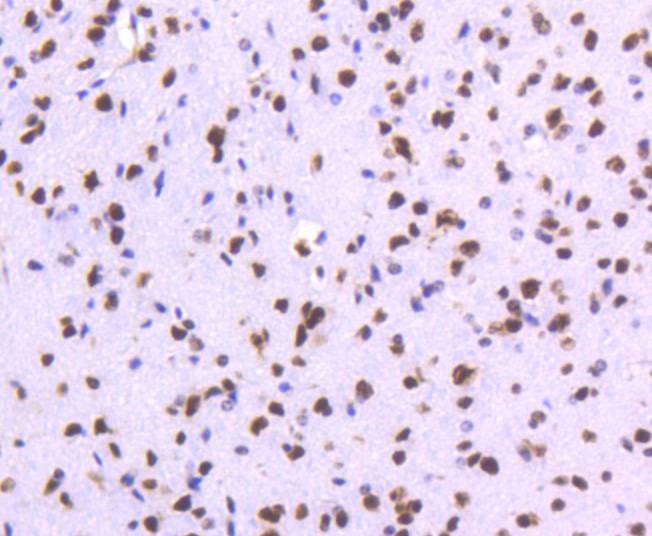 Anti-TOP1 Antibody (4H437)