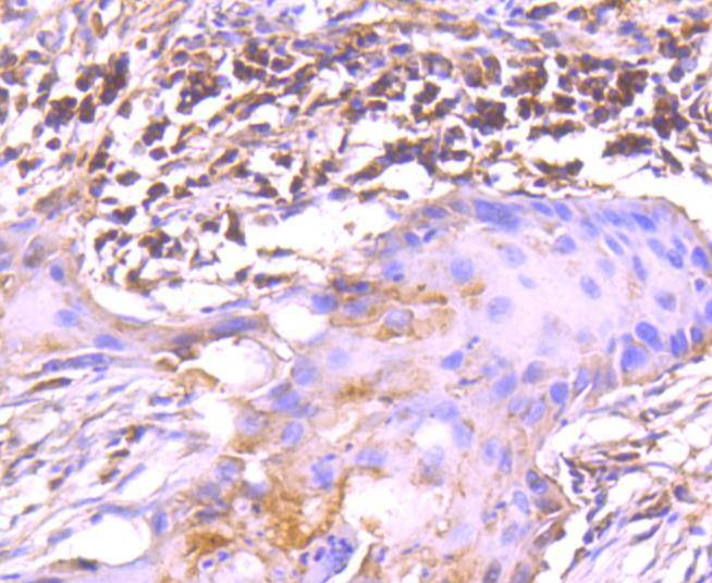 Anti-TRK fused gene Antibody (4L658)