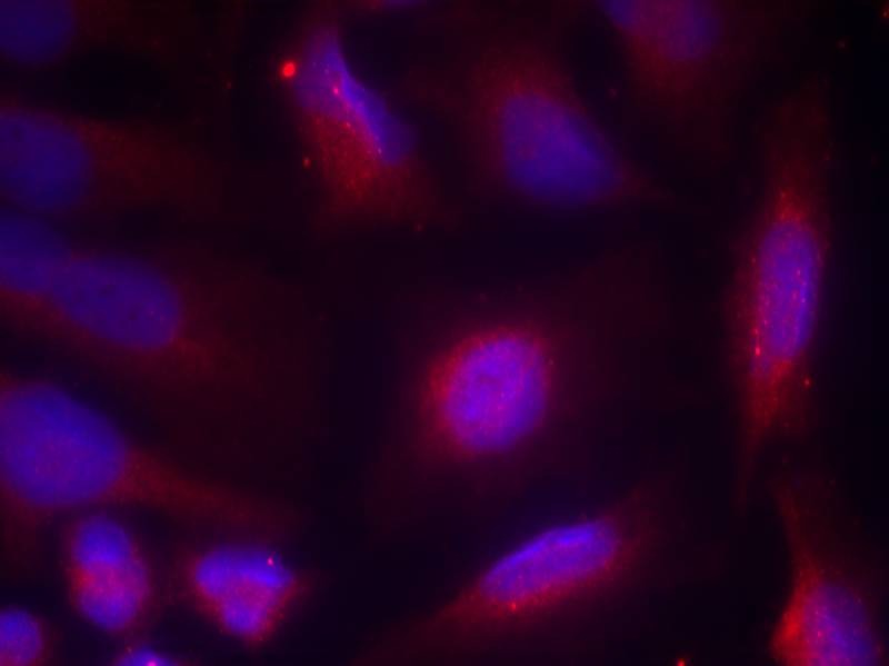 Anti-Phospho-TrkA (Ser791) Polyclonal Antibody