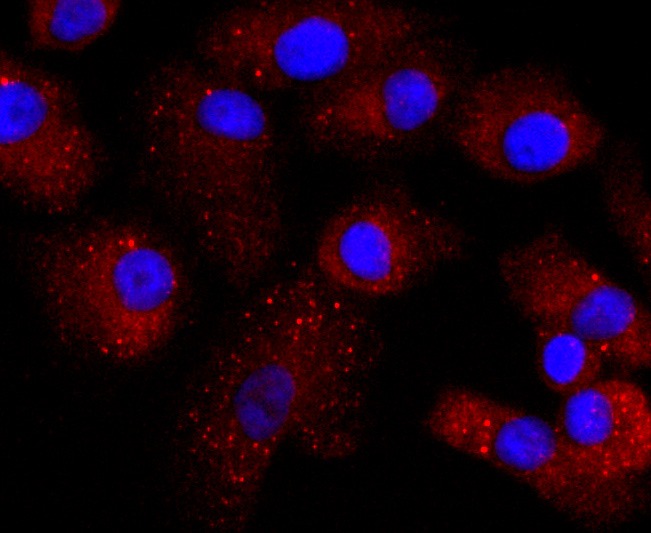 Anti-Transthyretin Antibody (5H602)