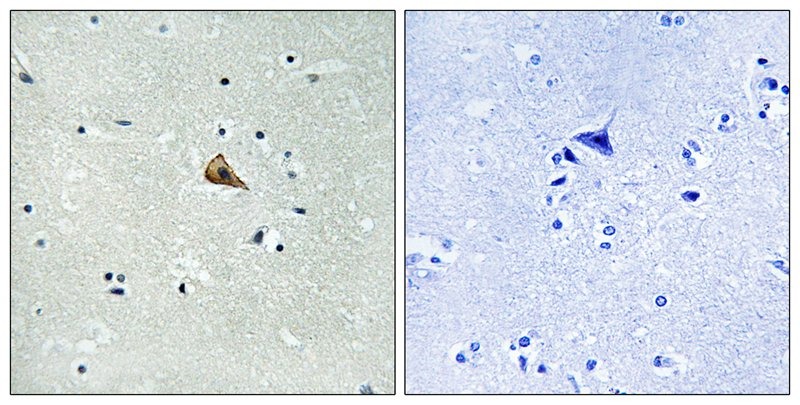 Anti-Phospho-TrkA (Tyr701) Polyclonal Antibody