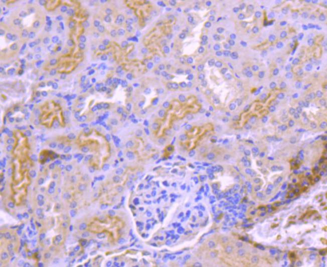 Anti-TrkA Antibody (8K93)