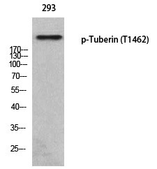 Anti-Phospho-Tuberin (Thr1462) Polyclonal Antibody
