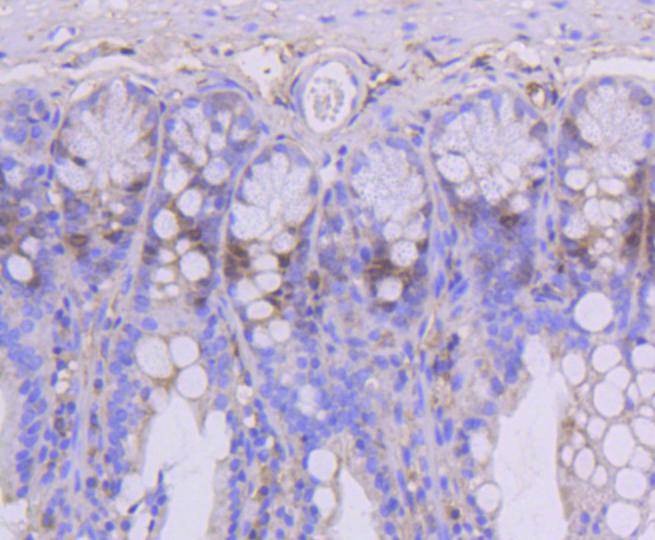 Anti-TOP2A Antibody (4D479)
