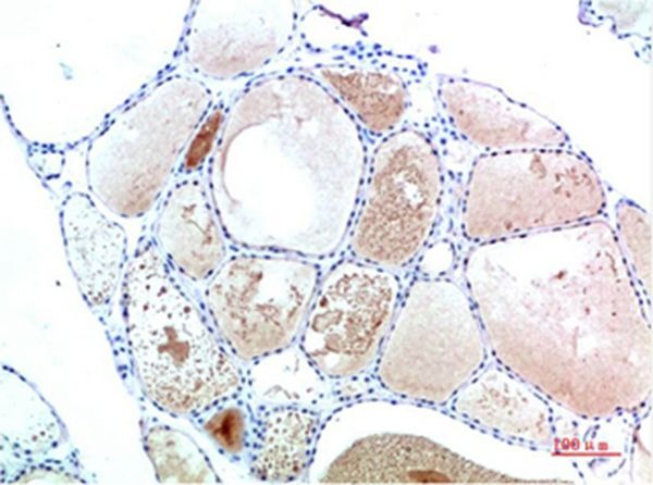 Anti-Transthyretin Antibody (8S642)