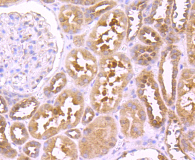 Anti-TNF RII Antibody (5O99)