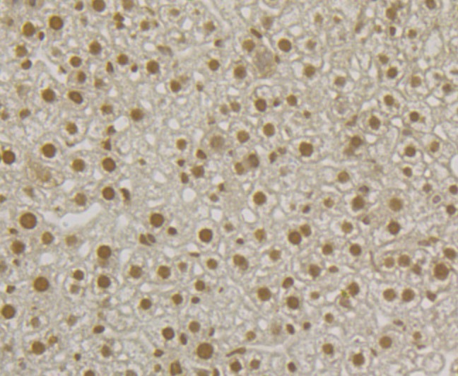 Anti-U1A Antibody (7N374)
