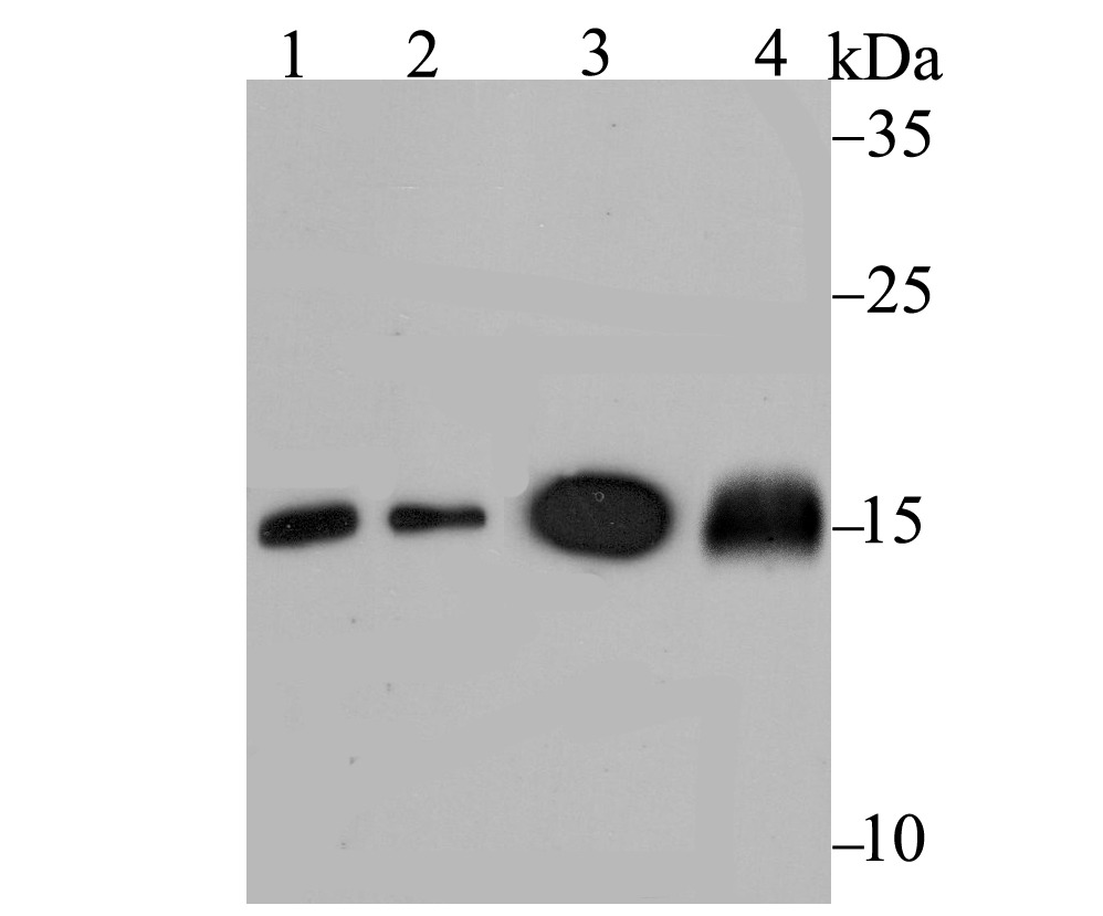 Anti-Ube2N Antibody (8H957)