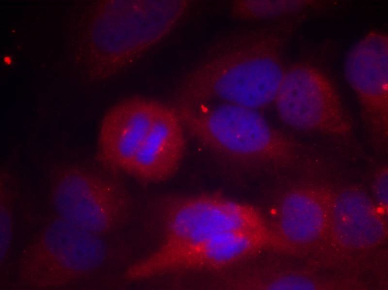 Anti-Phospho-Tyrosine Hydroxylase (Ser40) Polyclonal Antibody
