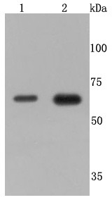 Anti-TNF RII Antibody (5O99)