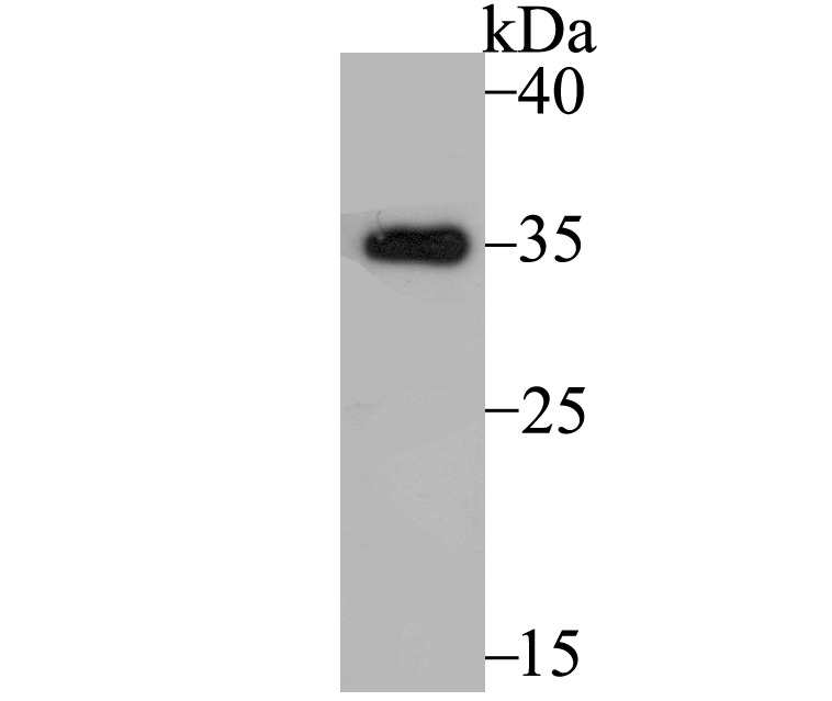 Anti-TPM1 Antibody (5W651)
