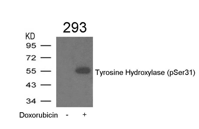 Anti-Phospho-Tyrosine Hydroxylase (Ser31) Polyclonal Antibody