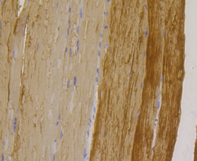 Anti-TPM1 Antibody (5W651)
