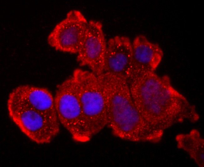 Anti-TNF RII Antibody (5O99)
