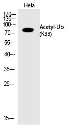 Anti-Acetyl-UBB (Lys33) Polyclonal Antibody