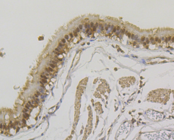 Anti-U1A Antibody (7N374)
