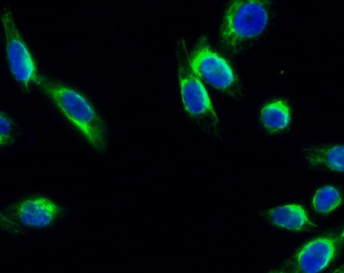 Anti-Phospho-NTRK2 (Tyr706) Polyclonal Antibody