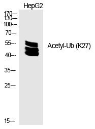 Anti-Acetyl-UBB (Lys27) Polyclonal Antibody
