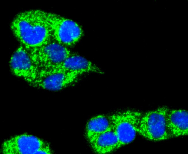 Anti-TNFAIP3 Antibody (3Z618)