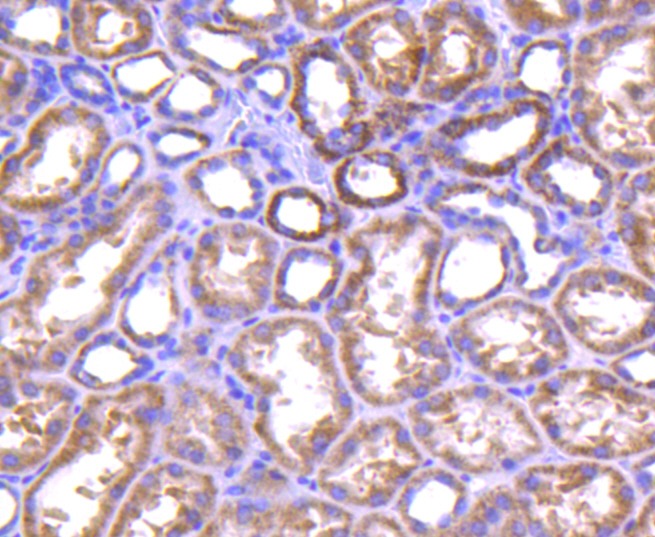 Anti-TNFAIP3 Antibody (3Z618)