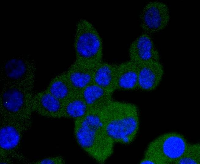 Anti-TrkA/B/C Antibody (9N825)