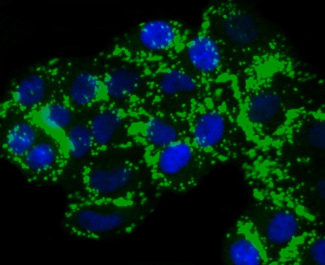 Anti-PYCARD Antibody (4C725)