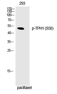 Anti-Phospho-TPH1 (Ser58) Polyclonal Antibody