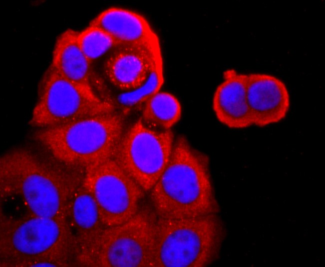 Anti-TNF RII Antibody (5O99)