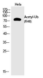 Anti-Acetyl-UBB (Lys48) Polyclonal Antibody