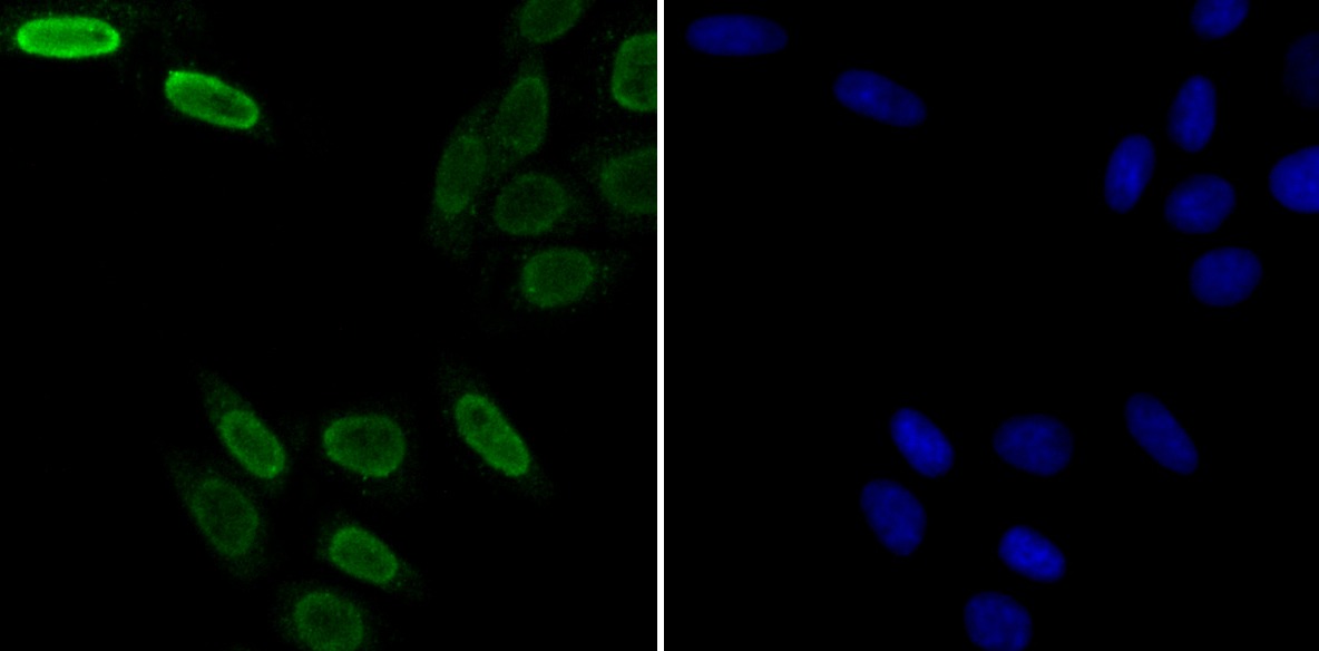 Anti-U1A Antibody (7N374)