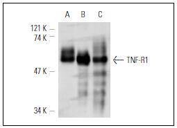 Anti-TNFR1/CD120a/TNFRSF1A Antibody (1K754)