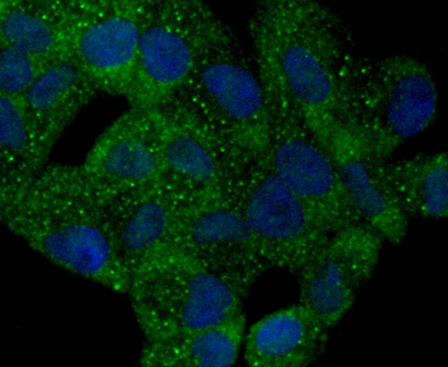 Anti-PYCARD Antibody (4C725)